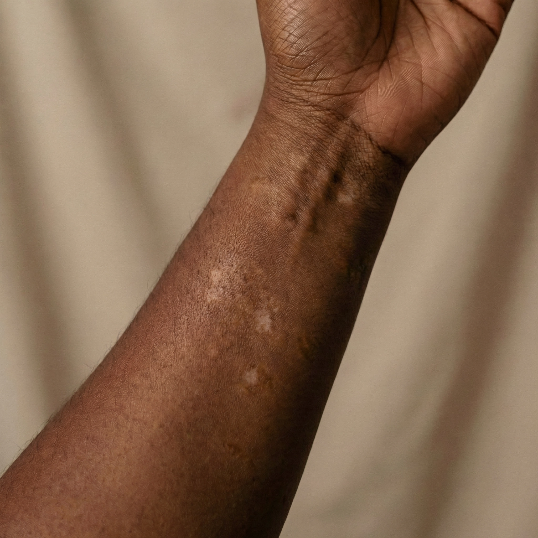 The Fair & Bright System — 3-Step Repigment Vitiligo Support Kit