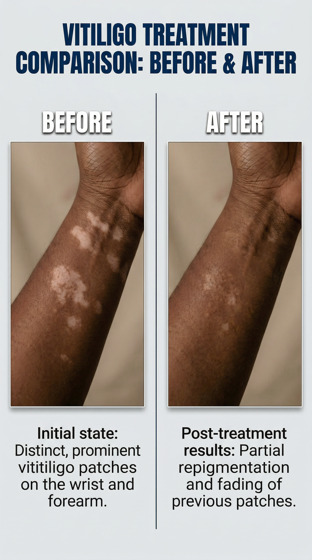 The Fair & Bright System — 3-Step Repigment Vitiligo Support Kit